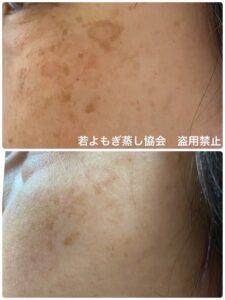 若よもぎ蒸し